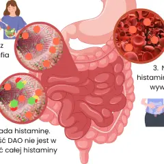 Ilustracja pokazuje, jak histamina z jedzenia trafia do jelit, gdzie enzym DAO próbuje ją rozłożyć. Nierozłożona histamina powoduje objawy, co podkreśla znaczenie diety antyhistaminowej.