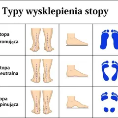 Jak wybrać buty do biegania? Poznaj typ stopy, uniknij kontuzji.