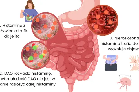 Ilustracja pokazuje, jak histamina z jedzenia trafia do jelit, gdzie enzym DAO próbuje ją rozłożyć. Nierozłożona histamina powoduje objawy, co podkreśla znaczenie diety antyhistaminowej.
