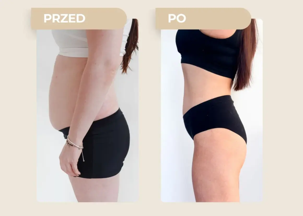 Przed i po: widoczna metamorfoza sylwetki, która pokazuje, jak schudnąć 10 kg.